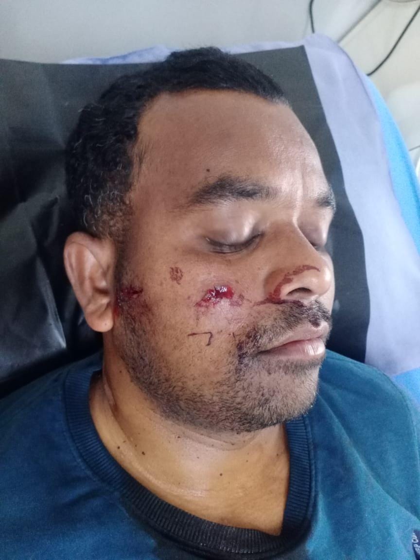 नामकुम में अपराधियों ने हाहाप पंचायत मुखिया को मारी गोली, हालत गंभीर |